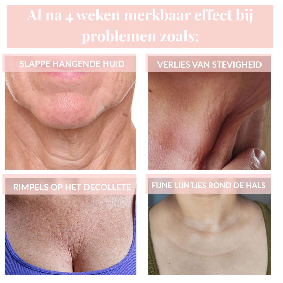 Voor en na resultaten decolleté anti-aging serum - strakkere hals na 4 weken gebruik