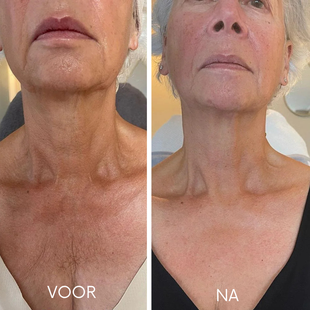 Textuur decolleté anti-aging serum - lichte gel formule met peptiden