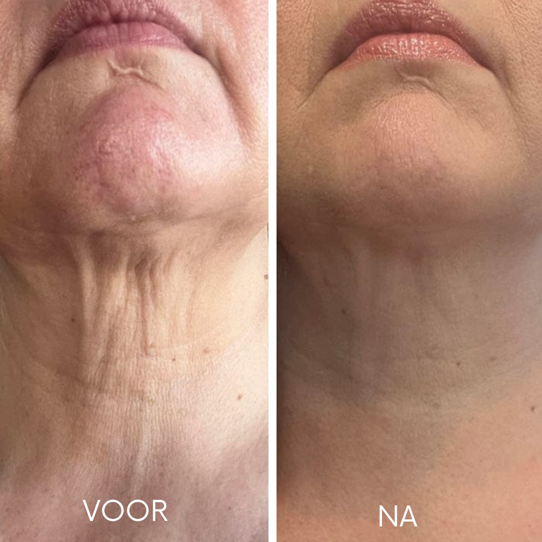 Vrouw brengt decolleté anti-aging serum aan met opwaartse bewegingen - TestedByHer applicatie instructie