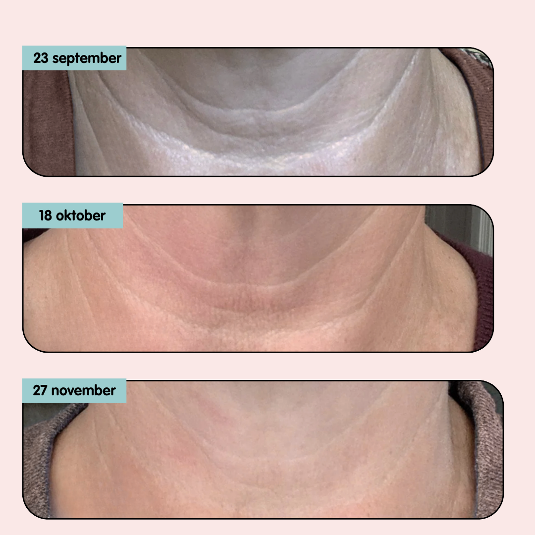 Decolleté Anti-Aging Serum - LiftLijn™ Peptiden |