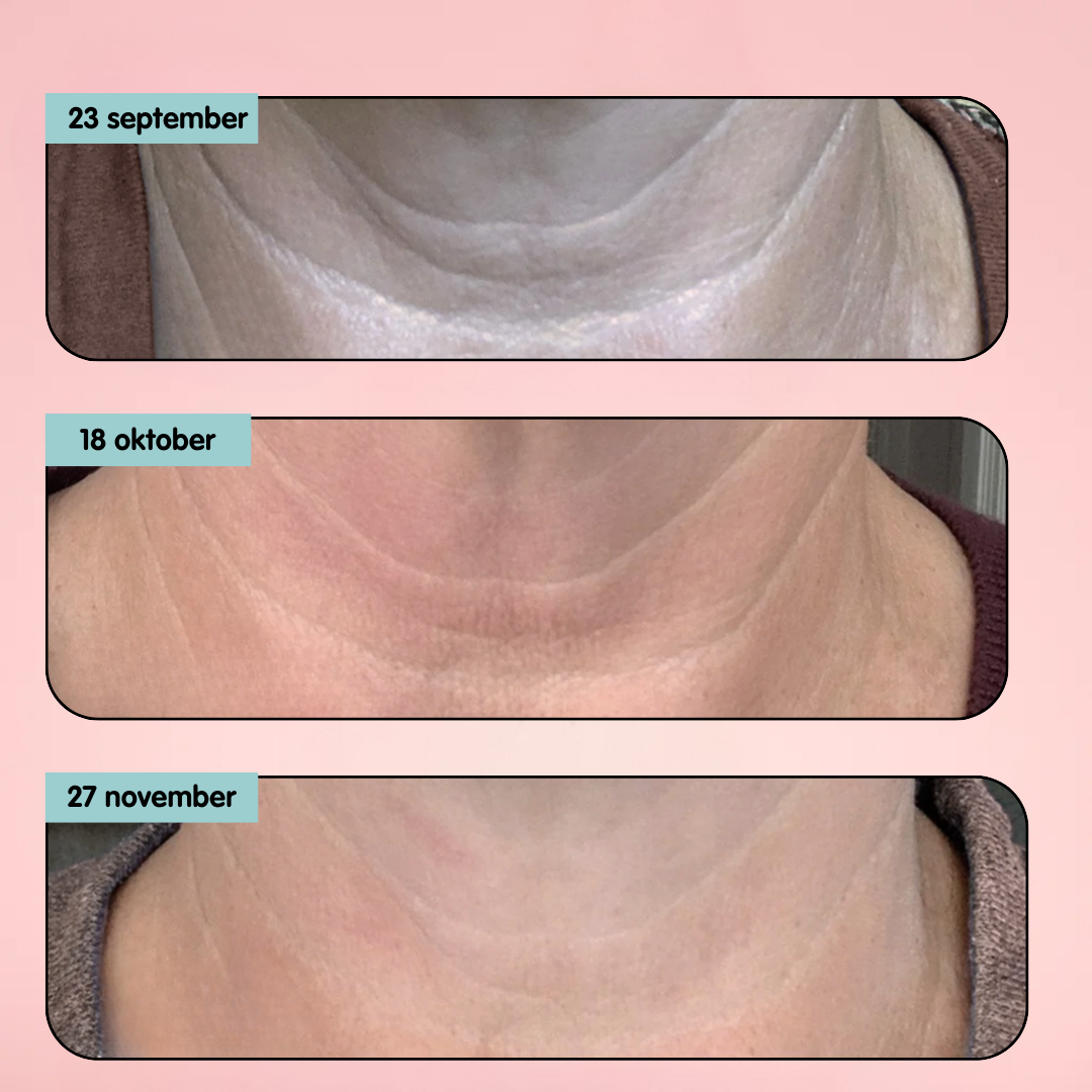 Decolleté Anti-Aging Serum - LiftLijn™ Peptiden