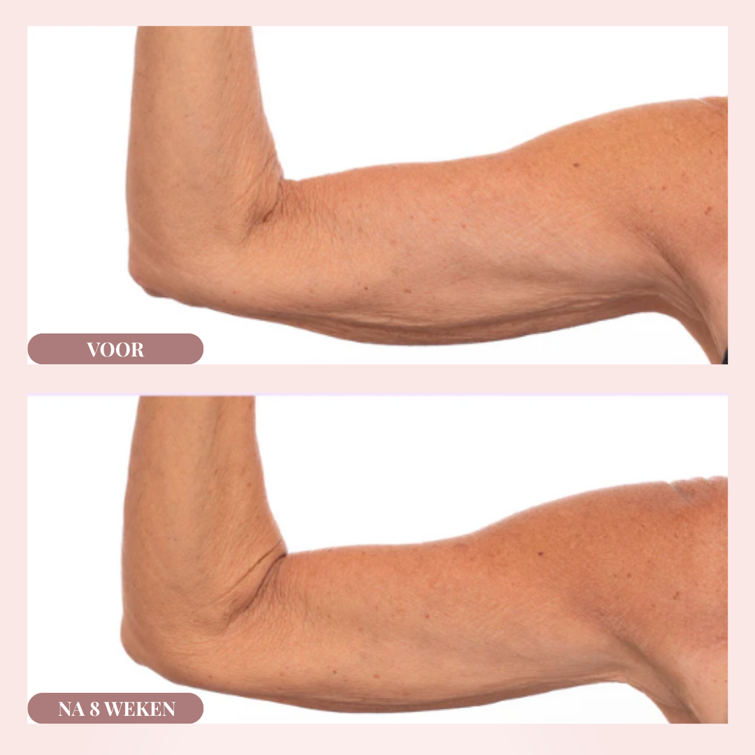 Lift & Firm Duo voor Armen, Hals & Decolleté