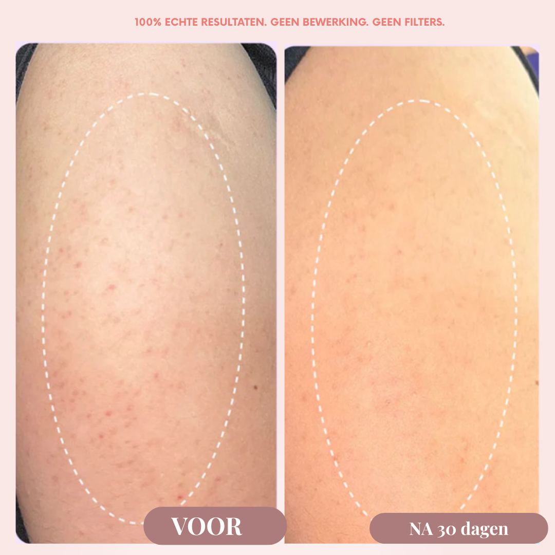 IJslandse Vulkaan AHA Scrub - Diepreinigende Exfoliant